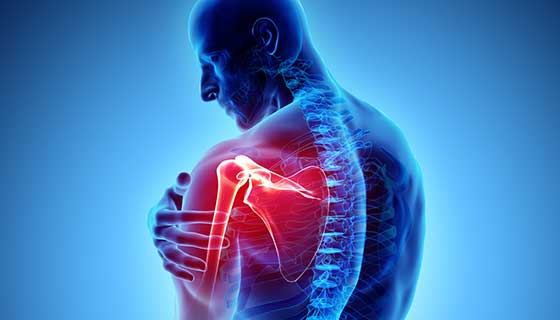 Shoulder pain, Frozon Shoulder,