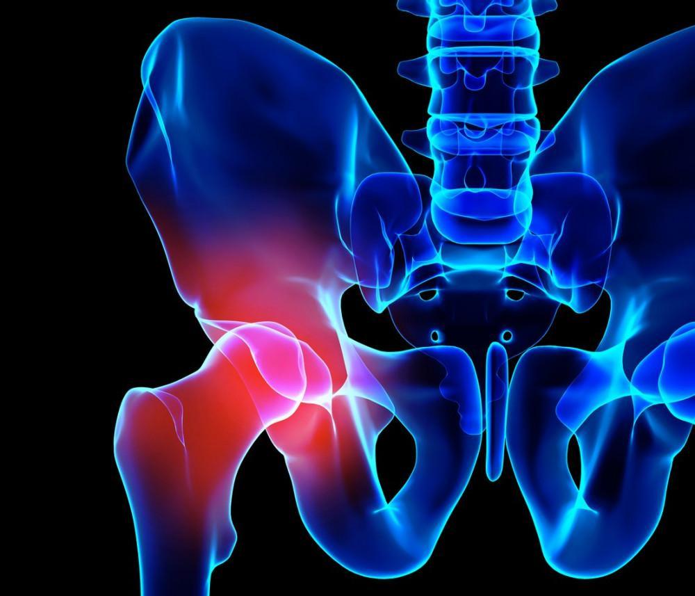 Hip pain