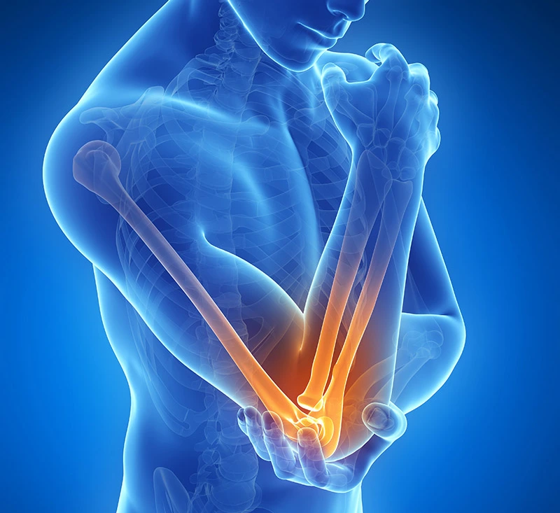 Elbow pain