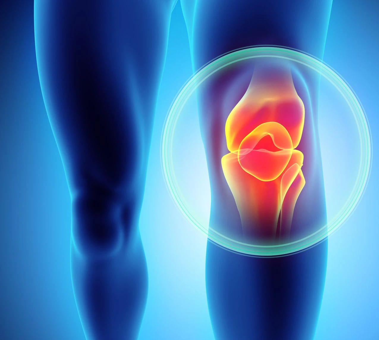 Knee pain and OA knees problem